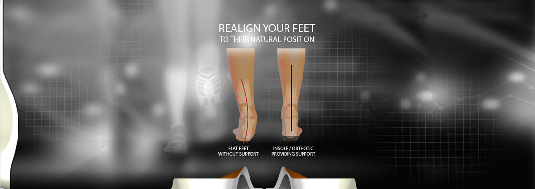 Realign your feet.